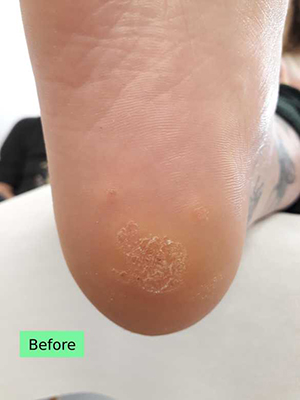 c.smith-resolved-1heel (1)